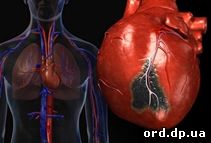 У Дніпропетровській області створюється сучасна система діагностики та лікування хвороб серця