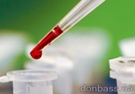На Дніпропетровщині завдяки новому методу обстеження крові вдвічі прискорилася швидкість проведення аналізів
